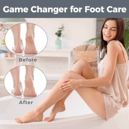 Foot File Foot Scrubber Pedicure - Callus Remover for Feet Easkep Professional Grater Rasp Foot Scraper Corns Callous Removers Cracked Dead Skin Remover for Dry and Wet Feet (Black)