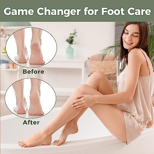 Foot File Foot Scrubber Pedicure - Callus Remover for Feet Easkep Professional Grater Rasp Foot Scraper Corns Callous Removers Cracked Dead Skin Remover for Dry and Wet Feet (Grey Green)