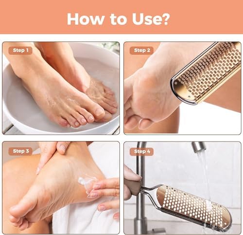 Foot File Foot Scrubber Pedicure - Callus Remover for Feet Easkep Professional Grater Rasp Foot Scraper Corns Callous Removers Cracked Dead Skin Remover for Dry and Wet Feet (Golden)
