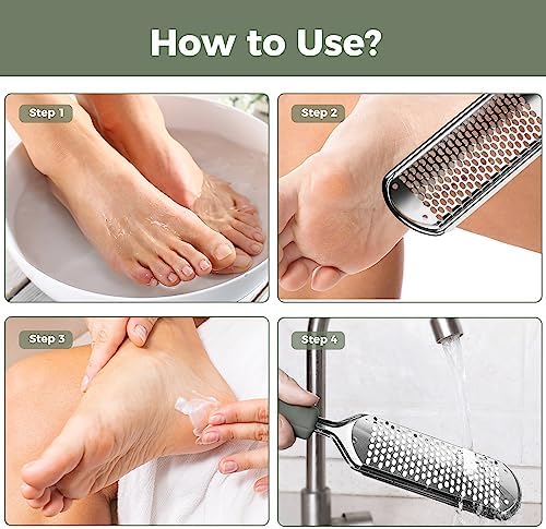Foot File Foot Scrubber Pedicure - Callus Remover for Feet Easkep Professional Grater Rasp Foot Scraper Corns Callous Removers Cracked Dead Skin Remover for Dry and Wet Feet (Grey Green)